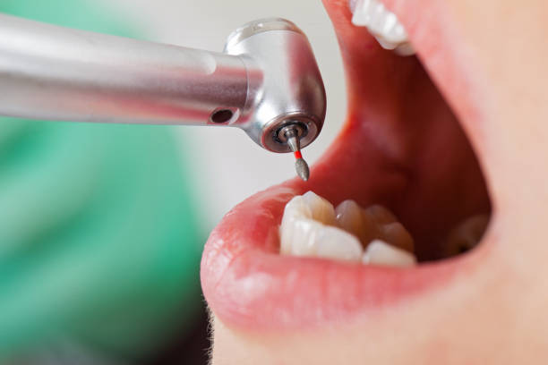 Best Emergency Treatment for Dental Infections or Abscesses in Grandville, MI